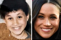 Click image for larger version. 

Name:	meghan-markle-plastic-surgery-4.jpg 
Views:	28 
Size:	31.0 KB 
ID:	14498