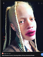 Click image for larger version. 

Name:	albino africans - Google Search.png 
Views:	79 
Size:	737.4 KB 
ID:	16485