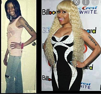 Click image for larger version. 

Name:	nicki minaj before and after surgery - Google Search.png 
Views:	116 
Size:	436.6 KB 
ID:	17806