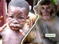 Click image for larger version. 

Name:	Monkeypox niggers.jpg 
Views:	19 
Size:	8.7 KB 
ID:	19815