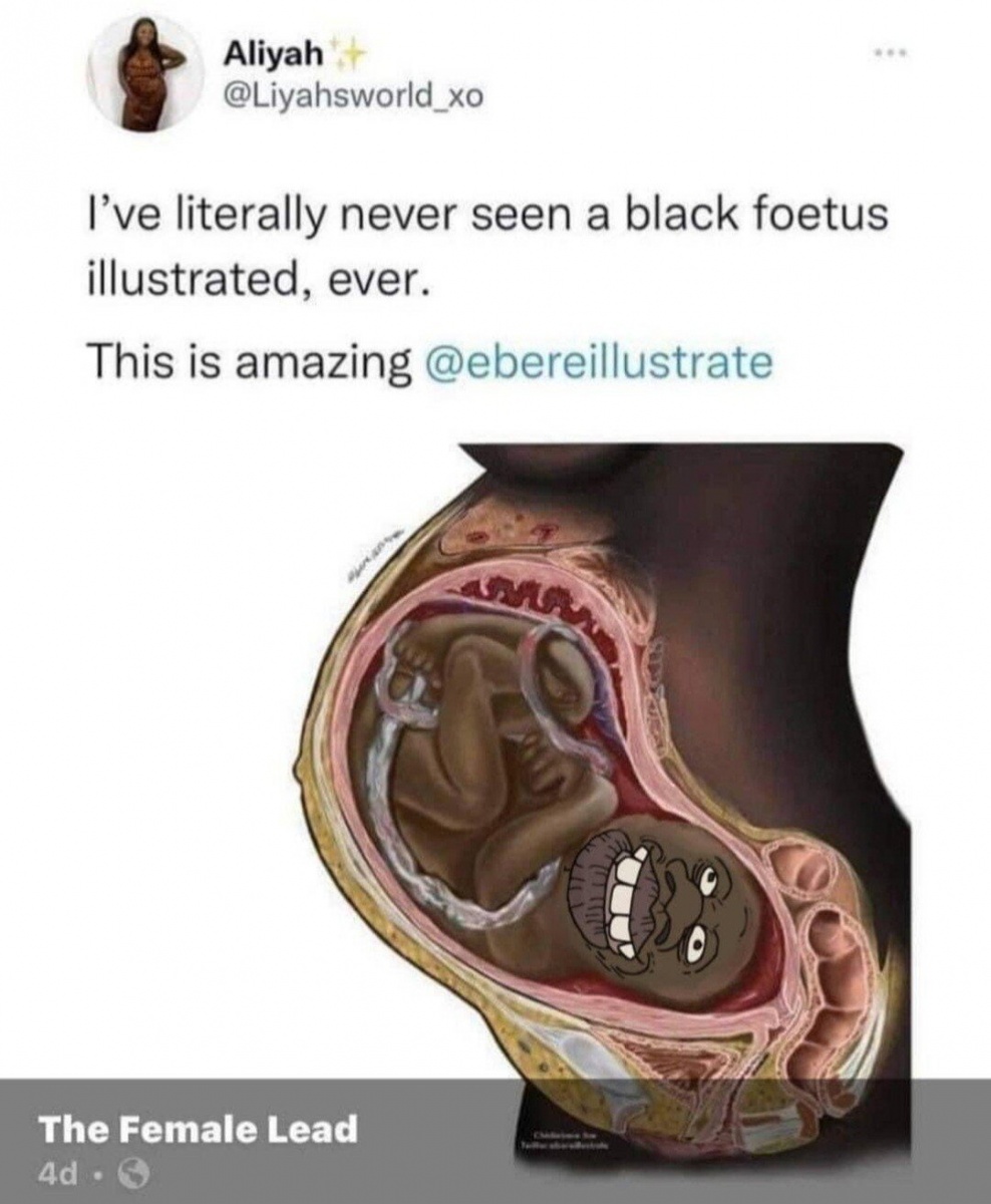 Name:  black fetus illustrated tyrone nigger 47098d010038fe07.jpg
Views: 1329
Size:  207.7 KB