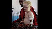 Click image for larger version. 

Name:	albino.jpg 
Views:	14 
Size:	40.0 KB 
ID:	24189