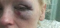 Click image for larger version. 

Name:	0_RSR_HDE_120719eye_02jpeg.jpg 
Views:	293 
Size:	28.7 KB 
ID:	9865