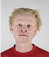 Click image for larger version. 

Name:	albino african - Google Search.png 
Views:	28 
Size:	156.2 KB 
ID:	22984