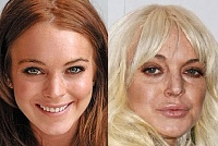 Click image for larger version. 

Name:	lindsay-lohan-plastic-surgery-after-3.jpg 
Views:	70 
Size:	48.2 KB 
ID:	9531