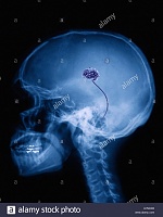 Click image for larger version. 

Name:	x-ray-of-the-human-skull-with-very-small-brain-H7NDD5.jpg 
Views:	65 
Size:	206.4 KB 
ID:	3651